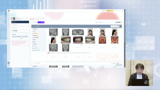 インビザライン契約数が爆増！WEBCEPH完全攻略の超実践編 AIトレース